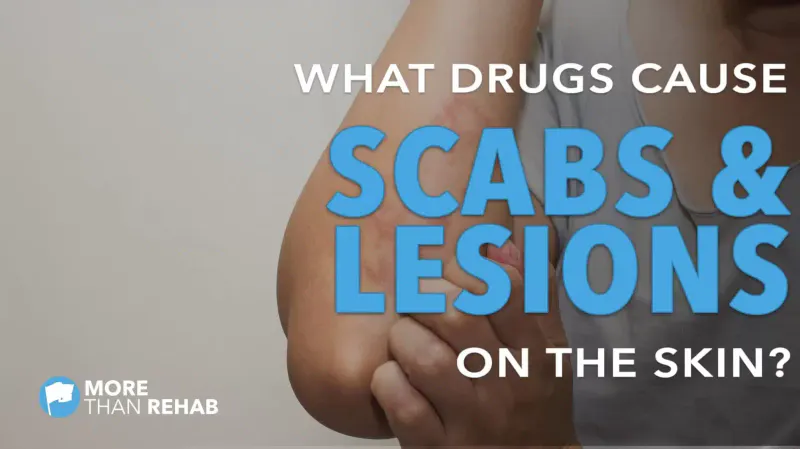 What Drugs Cause Scabs or Lesions on the Skin?